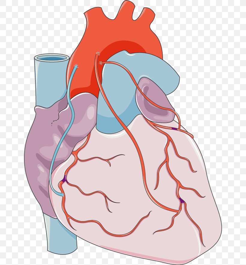 Heart Coronary Artery Bypass Surgery Vascular Bypass Coronary Arteries, PNG, 660x882px, Watercolor, Cartoon, Flower, Frame, Heart Download Free