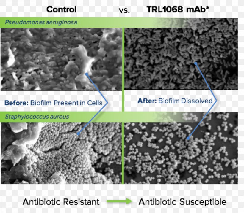 Soil Bacteria Antibody Broad-spectrum Antibiotic Chemical Affinity, PNG, 890x780px, Soil, Antibody, Bacteria, Broadspectrum Antibiotic, Chemical Affinity Download Free