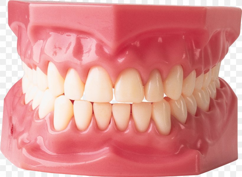 Cosmetic Dentistry Gums Human Tooth, PNG, 1680x1230px, Dentistry, Cosmetic Dentistry, Dental Implant, Dental Public Health, Dentist Download Free