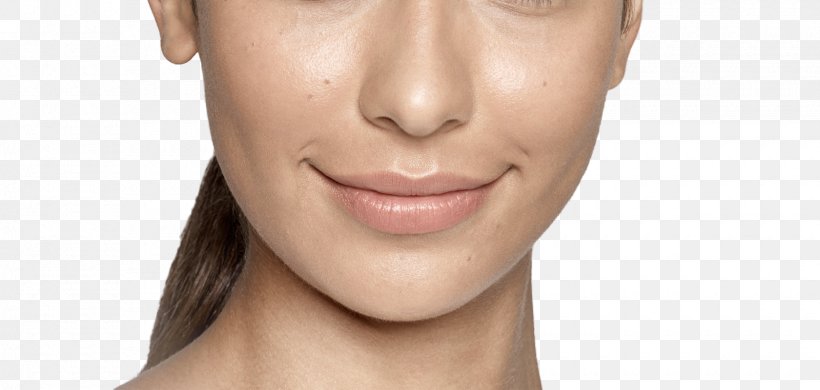 Lip Injectable Filler Restylane Cheek Nose, PNG, 1680x800px, Lip, Beauty, Cheek, Chin, Close Up Download Free