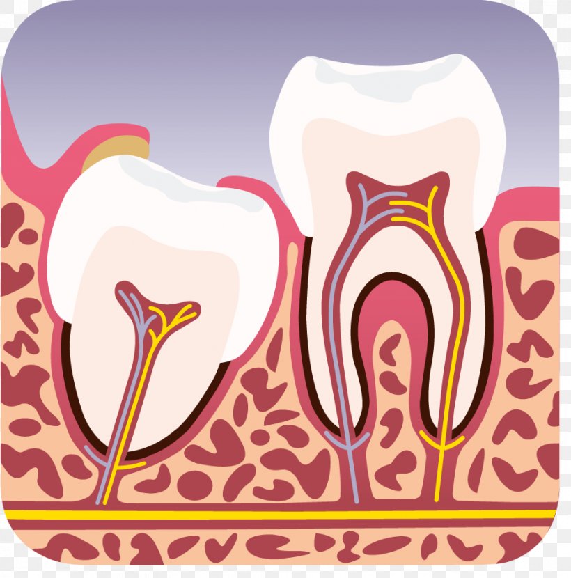 Wisdom Tooth Horten Tannlegesenter DA Dental Extraction Dentist, PNG, 928x940px, Watercolor, Cartoon, Flower, Frame, Heart Download Free