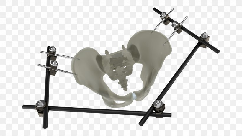 Pelvis Bone Fracture External Fixation Traction, PNG, 1200x675px, Watercolor, Cartoon, Flower, Frame, Heart Download Free