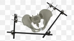 Pelvis - Pelvis Bone Fracture External Fixation Traction PNG