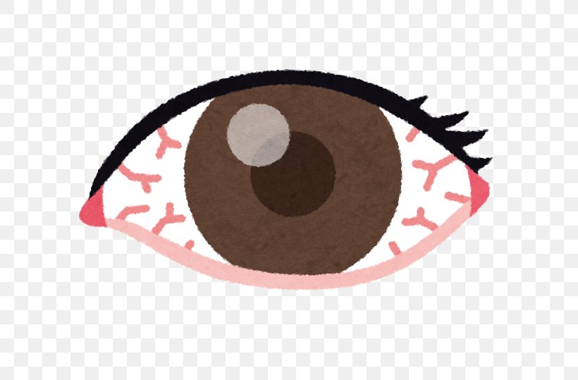 Red Eye Rheum Adenoviral Keratoconjunctivitis, PNG, 644x539px, Red Eye, Adenoviral Keratoconjunctivitis, Blindness, Conjunctiva, Conjunctivitis Download Free