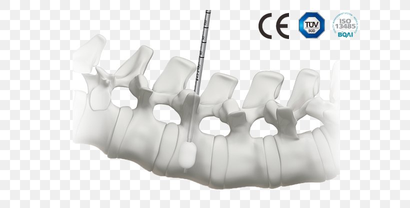 Orthopedic Surgery Medicine Vertebral Column, PNG, 635x416px, Surgery, Business, Cervical Vertebrae, Implant, Internal Fixation Download Free