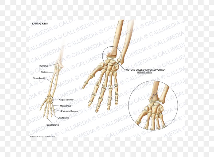 Bone Fracture Carpal Bones Wrist Pisiform Bone, PNG, 600x600px, Watercolor, Cartoon, Flower, Frame, Heart Download Free