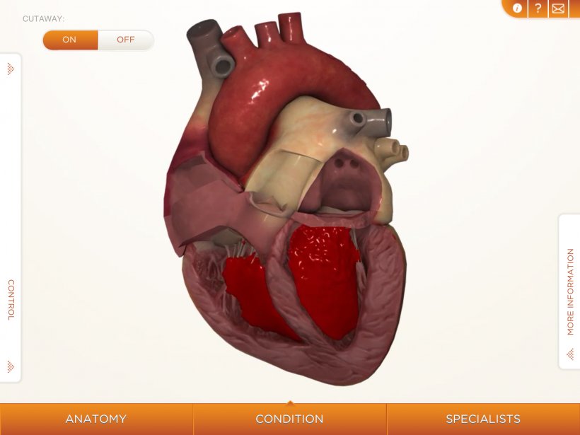 Heart Cardiovascular Disease Human Body Anatomy Muscle, PNG, 2048x1536px, Watercolor, Cartoon, Flower, Frame, Heart Download Free