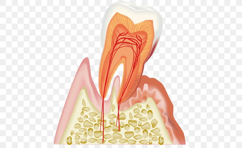 Dentistry Periodontal Disease 歯科 Gums, PNG, 500x500px, Watercolor, Cartoon, Flower, Frame, Heart Download Free