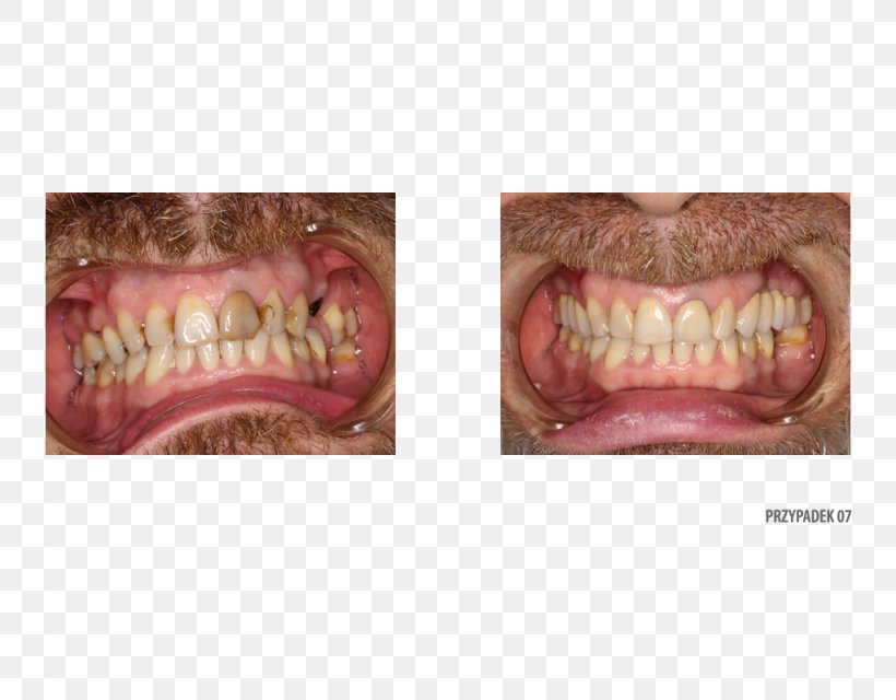 Dr. Brett Egelske Lombard Street Jaw Dentistry Yelp, PNG, 1024x800px, Watercolor, Cartoon, Flower, Frame, Heart Download Free
