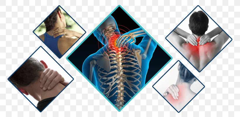 Neck Pain Human Back Chiropractic Hip Pain Back Pain, PNG, 800x400px, Neck Pain, Ache, Back Pain, Chiropractic, Chiropractor Download Free