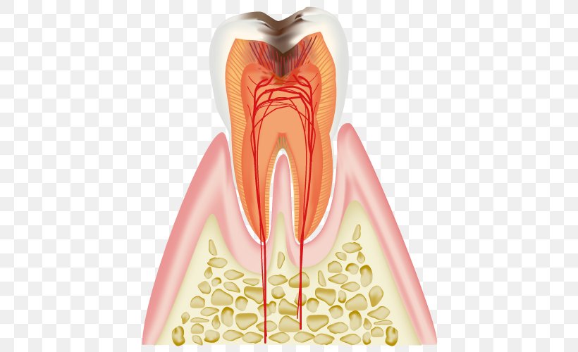 歯科 Dentist Tooth Decay Periodontal Disease, PNG, 500x500px, Watercolor, Cartoon, Flower, Frame, Heart Download Free