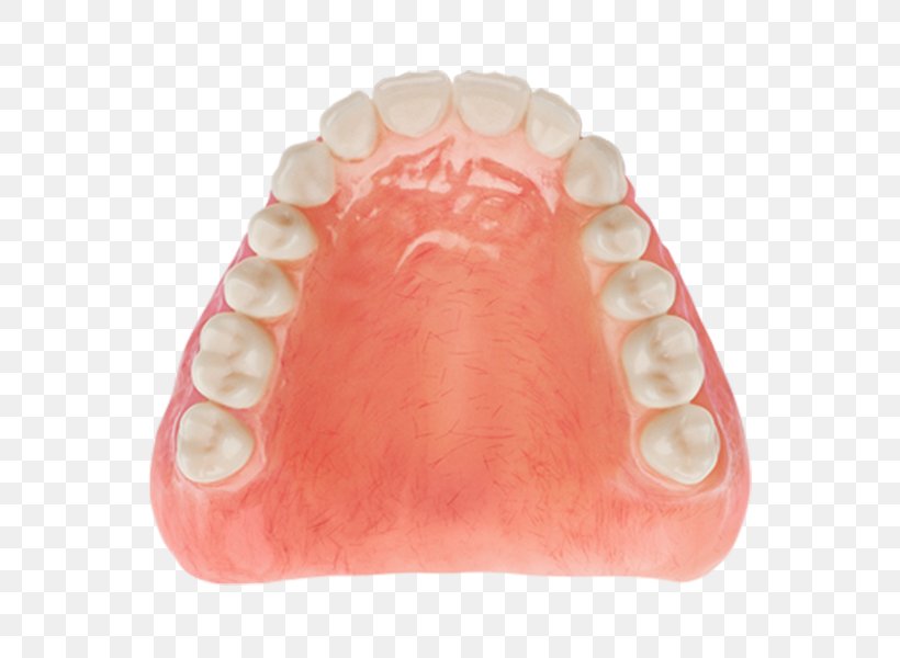 Tooth Dentures Dentistry Diagnostic Wax-up, PNG, 800x600px, Tooth, Aspen Dental, Auto Detailing, Dentist, Dentistry Download Free