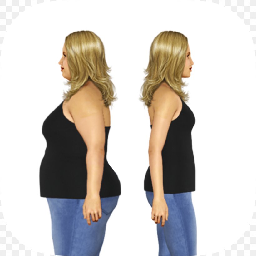 Weight Loss Coaching The Hypnotic Gastric Band Exercise Diet, PNG, 1024x1024px, Weight Loss, Adjustable Gastric Band, App Store, Arm, Body Mass Index Download Free