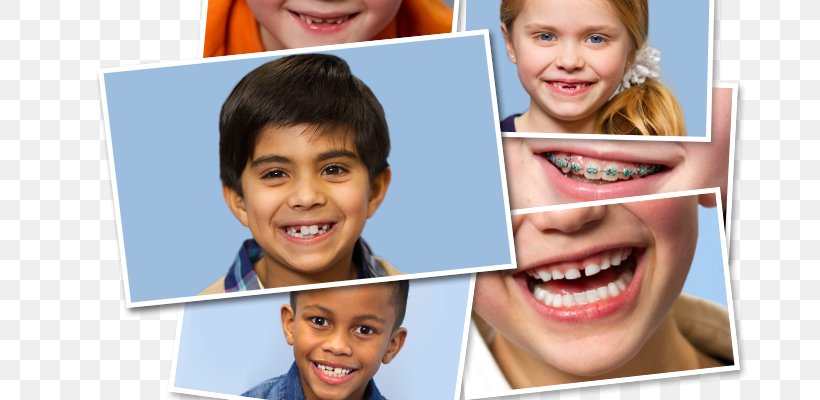 Stellar Kids Dentistry Mill Creek Pediatric Dentistry Child, PNG, 700x400px, Dentist, Child, Chin, Cosmetic Dentistry, Dentistry Download Free