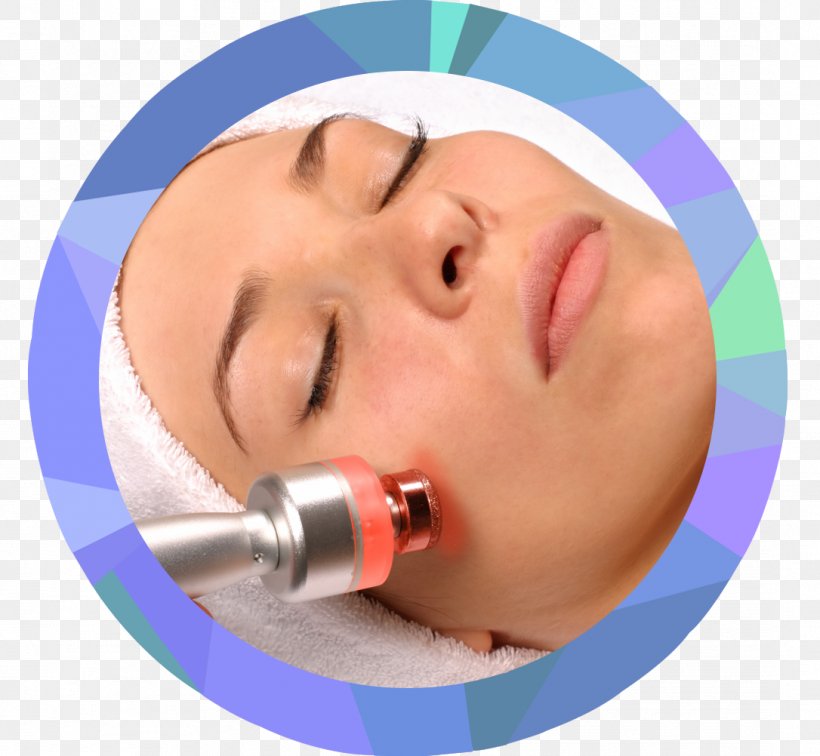 Skin Microdermabrasion Exfoliation Mesotherapy Health, PNG, 1086x1002px, Skin, Aesthetics, Cheek, Chin, Collagen Download Free