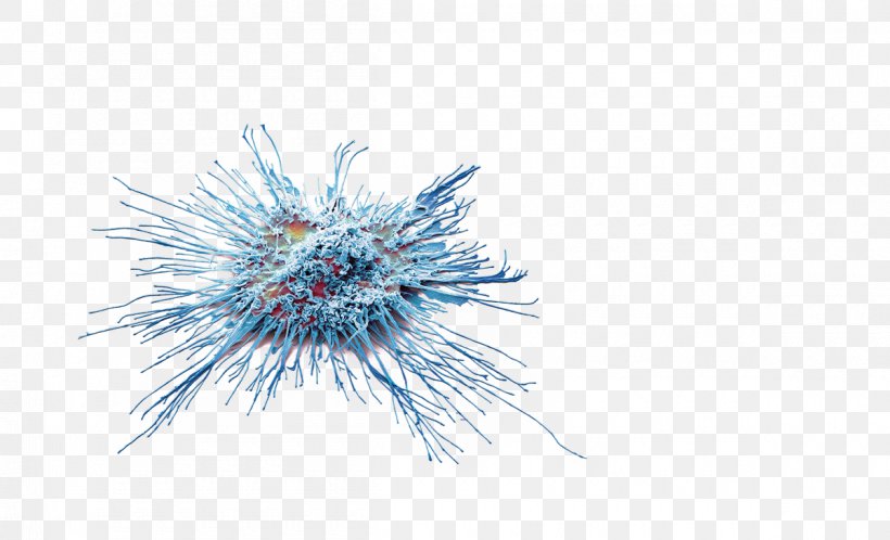 Dendritic Cell Immunotherapy Cancer Allergopharma GmbH & Co. KG Skin, PNG, 1200x730px, 2017, Dendritic Cell, Blue, Cancer, Close Up Download Free