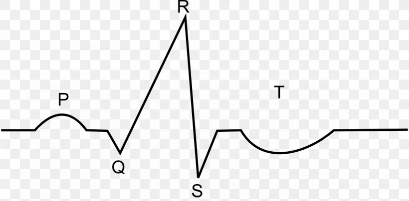 ECG Interpretation Electrocardiography Atrial Fibrillation Clip Art ...