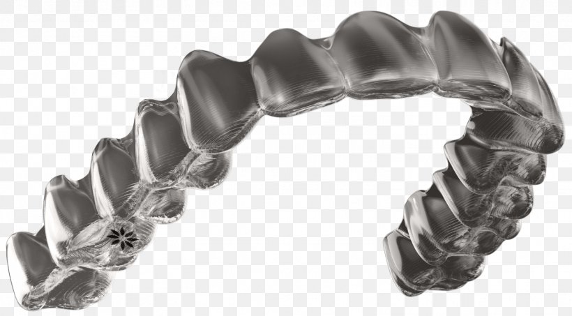 Clear Aligners Dentistry Dental Braces Orthodontics Tooth, PNG, 1524x843px, Clear Aligners, Bracelet, Chain, Dental Braces, Dental Surgery Download Free