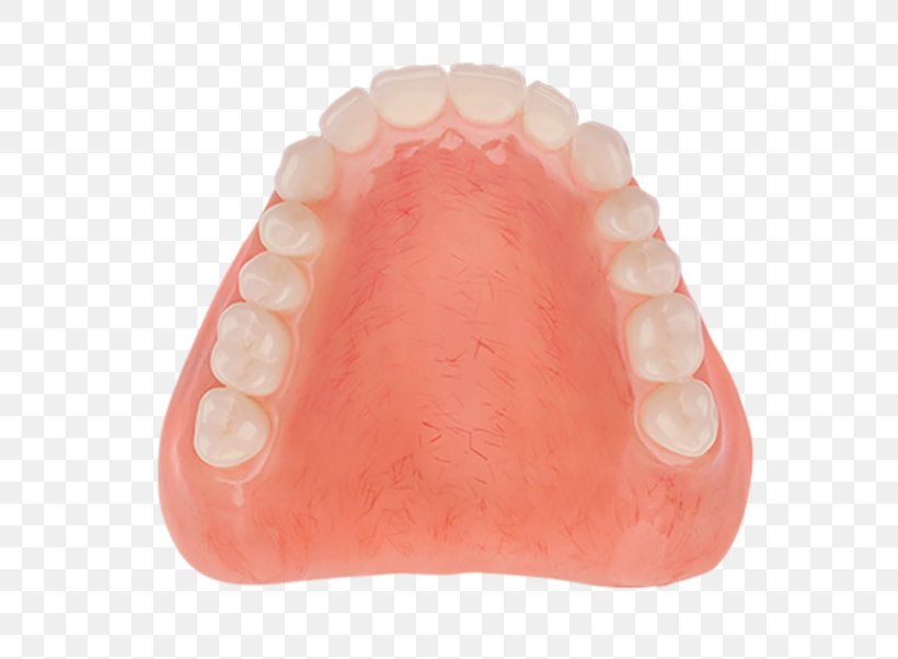 Dentures Tooth Dentistry Acrylic Resin Poly, PNG, 800x602px, Dentures, Acrylic Resin, Aspen Dental, Dentistry, Jaw Download Free