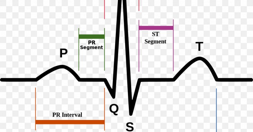 Electrocardiography Heart Rate Pulse Diagram, PNG, 1024x538px, Watercolor, Cartoon, Flower, Frame, Heart Download Free