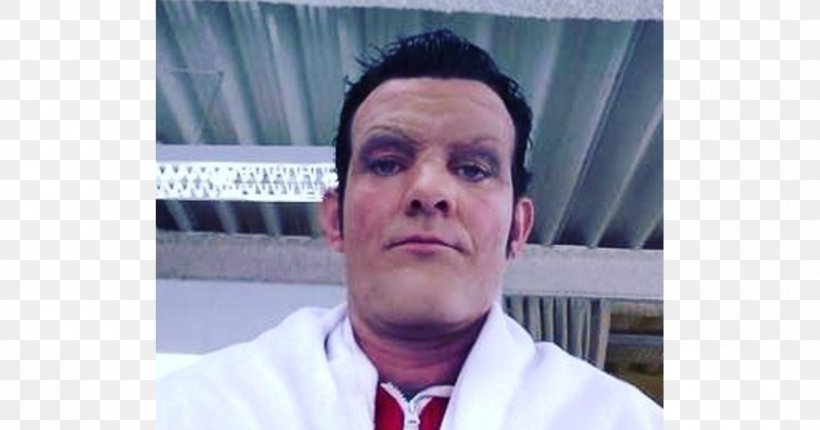 Stefán Karl Stefánsson LazyTown Robbie Rotten Stephanie Iceland, PNG, 1200x630px, Lazytown, Actor, Chin, Cholangiocarcinoma, Forehead Download Free