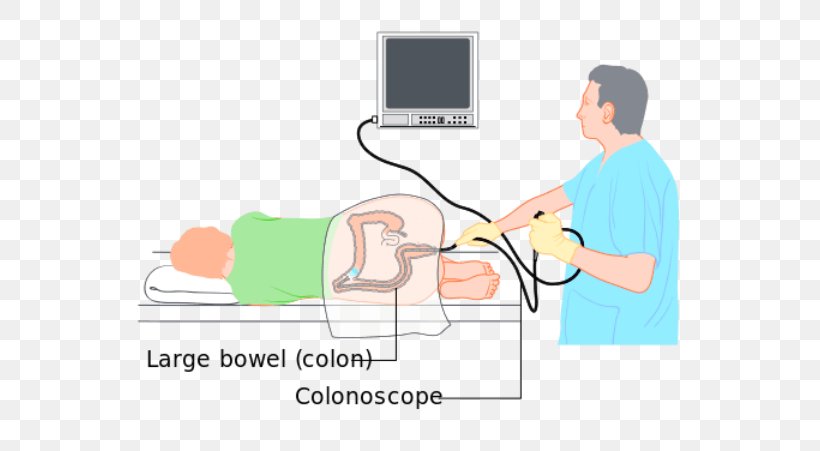 Colonoscopy Wiring Diagram Large Intestine Diverticulosis, PNG, 600x451px, Watercolor, Cartoon, Flower, Frame, Heart Download Free