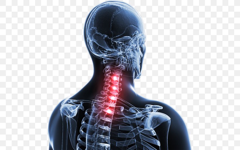 Spinal Disc Herniation Neck Pain Vertebral Column Thoracic Vertebrae, PNG, 494x513px, Watercolor, Cartoon, Flower, Frame, Heart Download Free