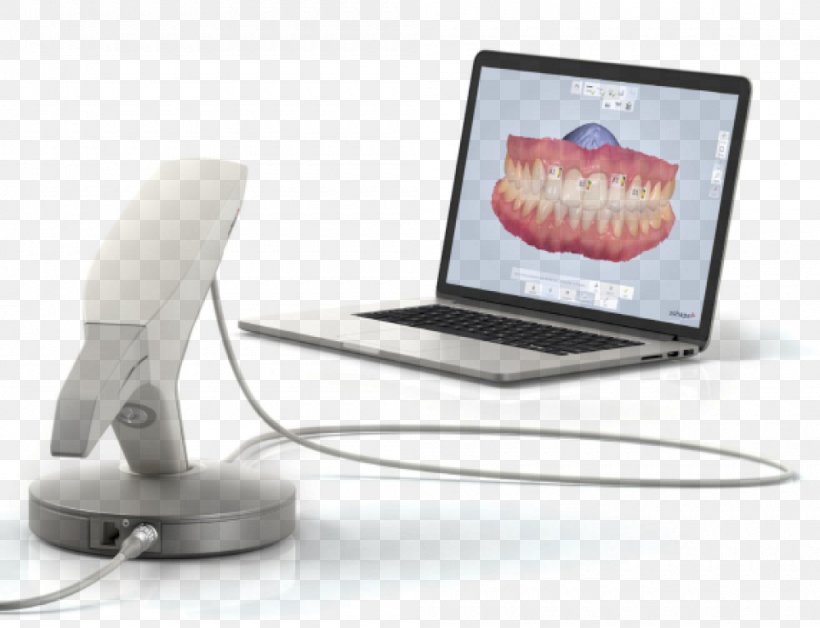 3Shape Dentistry Image Scanner 3D Scanner, PNG, 1000x766px, 3d Scanner, Dentistry, Cadcam Dentistry, Dental Implant, Dental Impression Download Free