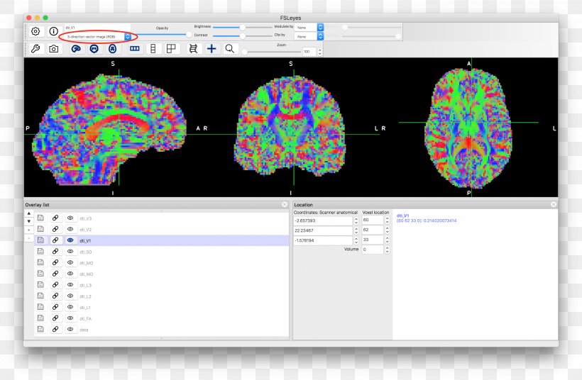 Diffusion MRI Scalar Tensor Corticospinal Tract, PNG, 2816x1844px, Diffusion Mri, Brain, Brand, Corticospinal Tract, Data Download Free