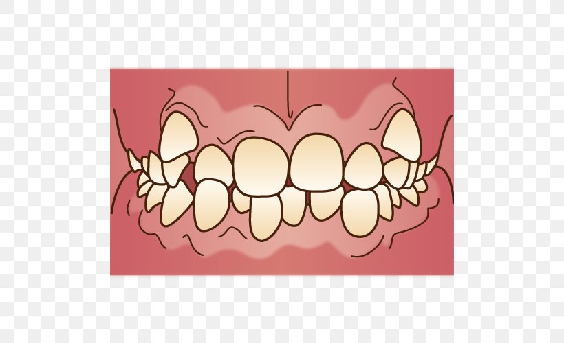 Dental Braces 矯正歯科 Dentist Mouthguard, PNG, 500x500px, Watercolor, Cartoon, Flower, Frame, Heart Download Free