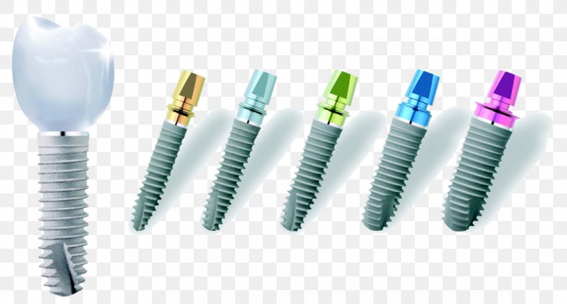 Dental Implant Dentistry Prosthesis XiVE, PNG, 1067x573px, Implant, Bone, Crown, Debridement, Dental Implant Download Free