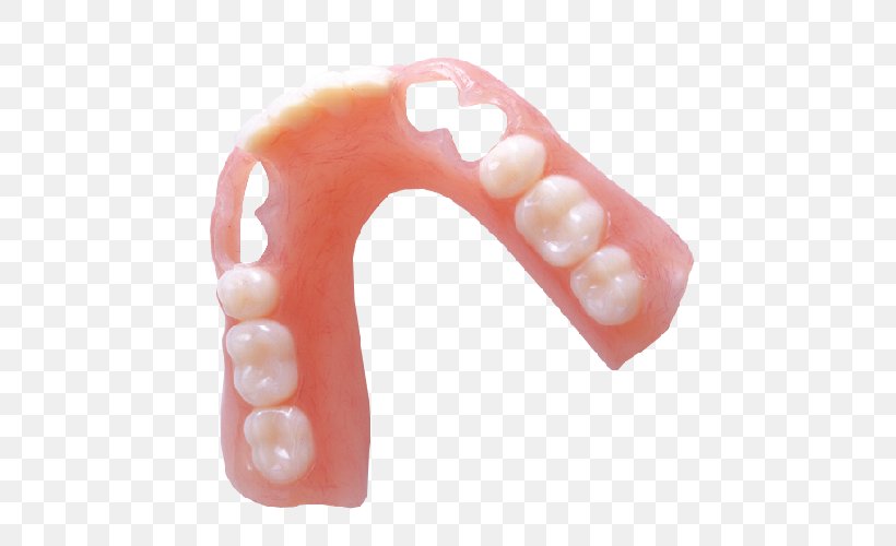 Dentures Removable Partial Denture Dental Laboratory Dentistry Vitallium, PNG, 501x500px, Dentures, Acrylic Resin, Allure Dental Lab, Biocompatibility, Body Jewelry Download Free