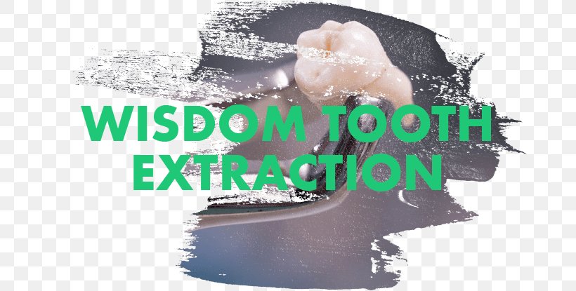 Wisdom Tooth Dentist Human Tooth Dental Extraction, PNG, 680x415px, Wisdom Tooth, Brand, Dental Extraction, Dentist, Fremont Download Free