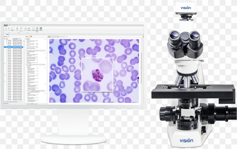 Microscope Quartan Malaria Technology, PNG, 1500x944px, Microscope, Camera, Camera Accessory, Malaria, Malaria Parasite Download Free