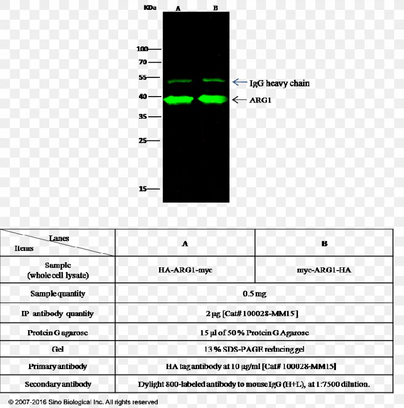 Alanine Aminopeptidase Protease Protein Small Intestine, PNG, 861x870px, Aminopeptidase, Antibody, Area, Biology, Brand Download Free