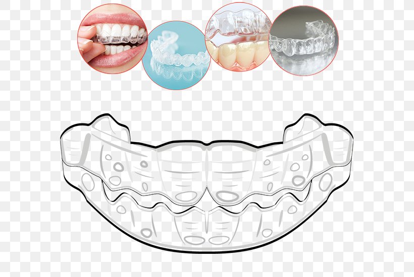 Tooth Clear Aligners Orthodontics Therapy Mouth, PNG, 581x550px, Watercolor, Cartoon, Flower, Frame, Heart Download Free