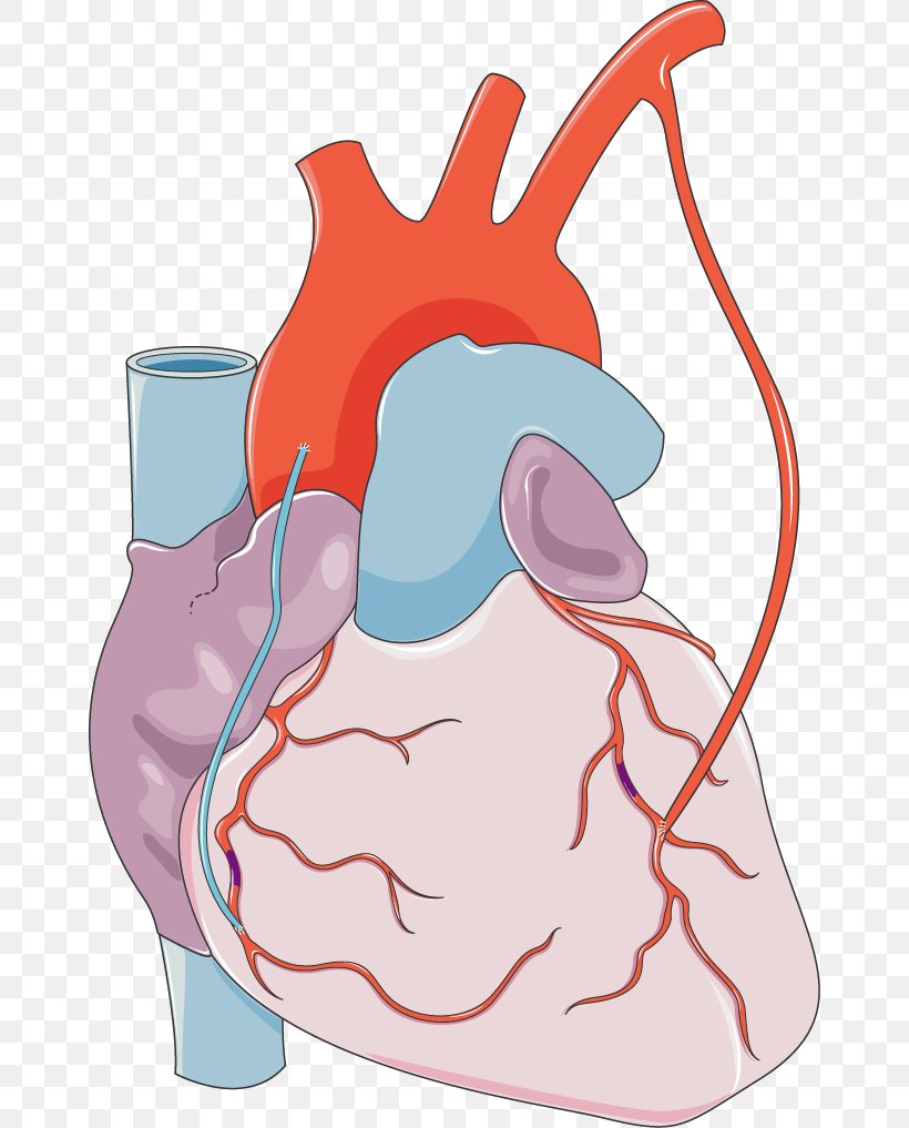Myocardial Infarction Heart Coronary Artery Disease Blood, PNG, 660x1017px, Watercolor, Cartoon, Flower, Frame, Heart Download Free