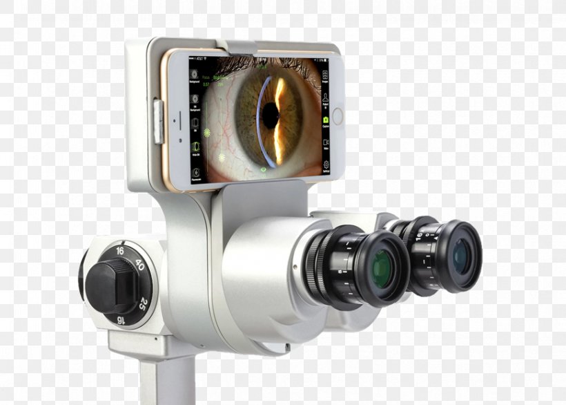 Slit Lamp Ophthalmology Anterior Segment Of Eyeball Ocular Tonometry, PNG, 869x622px, Slit Lamp, Anterior Segment Of Eyeball, Camera, Camera Accessory, Camera Lens Download Free