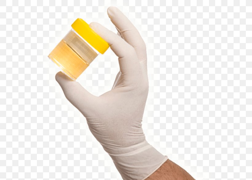 Thumb United States Vetoxa Records, PNG, 593x585px, Thumb, Arm, Clinical Urine Tests, Finger, Glove Download Free