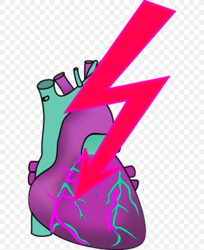 Heart Myocardial Infarction Clip Art, PNG, 600x1004px, Heart, Art, Artwork, Blood, Cardiac Muscle Download Free