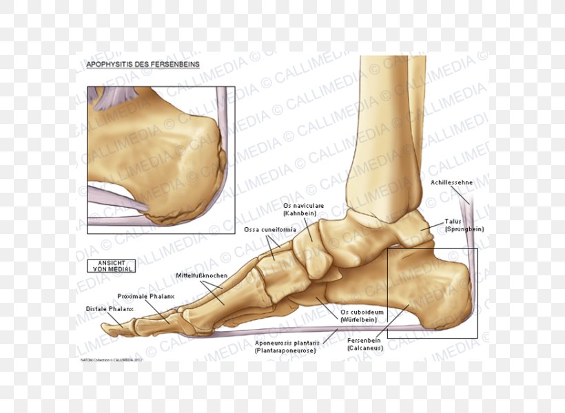 Foot Sever's Disease Osteochondrosis Podiatry, PNG, 600x600px, Watercolor, Cartoon, Flower, Frame, Heart Download Free