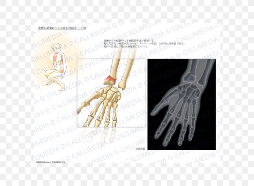 Thumb Product Design Hand Model Human, PNG, 600x600px, Thumb, Arm, Bone, Finger, Hand Download Free