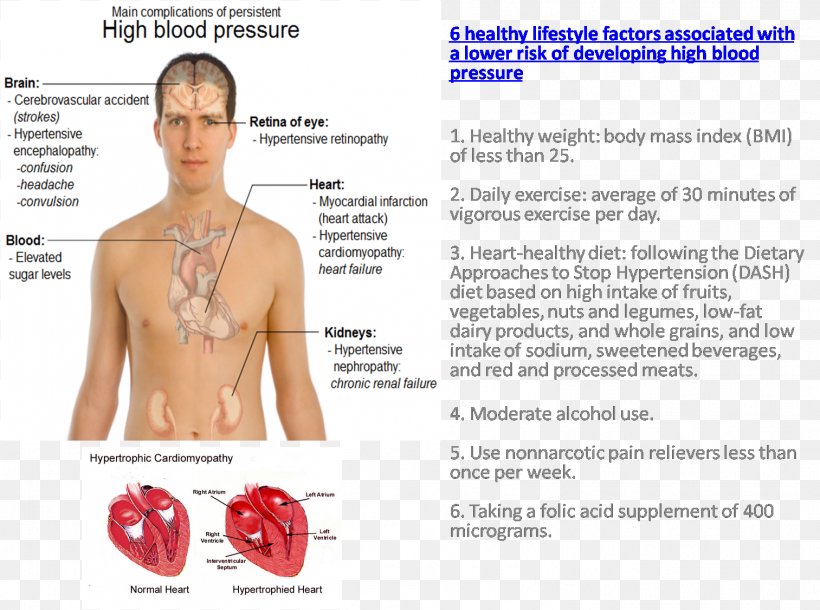 Hypertension Blood Pressure Headache Disease Pain, PNG, 1513x1127px, Watercolor, Cartoon, Flower, Frame, Heart Download Free