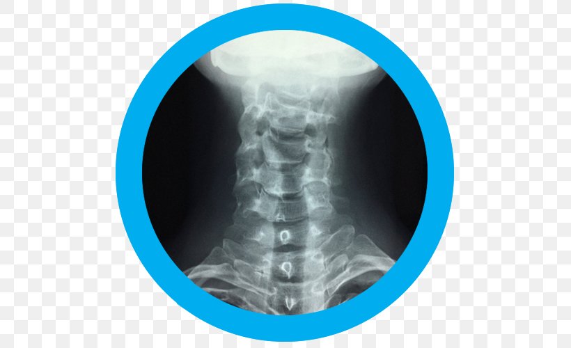 Computed Tomography Radiology Medical Radiography X-ray, PNG, 500x500px, Computed Tomography, Jaw, Joint, Medical, Medical Imaging Download Free