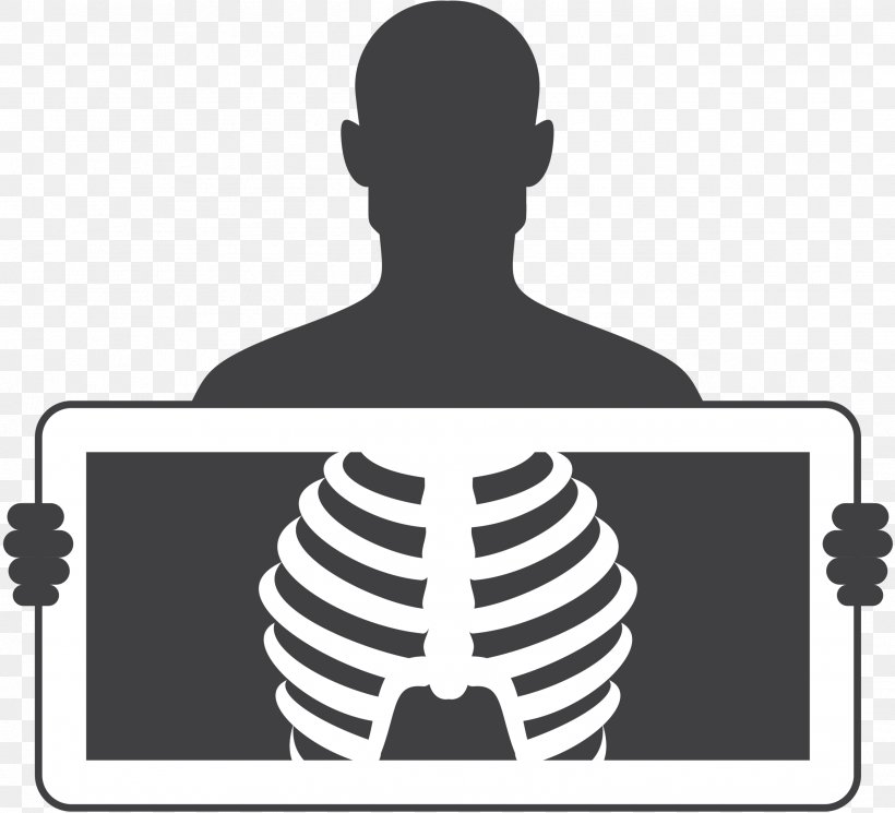 X-ray Medicine Tuberculosis Image Vector Graphics, PNG, 2593x2358px, Xray, Audio Equipment, Blackandwhite, Bone, Electronic Device Download Free