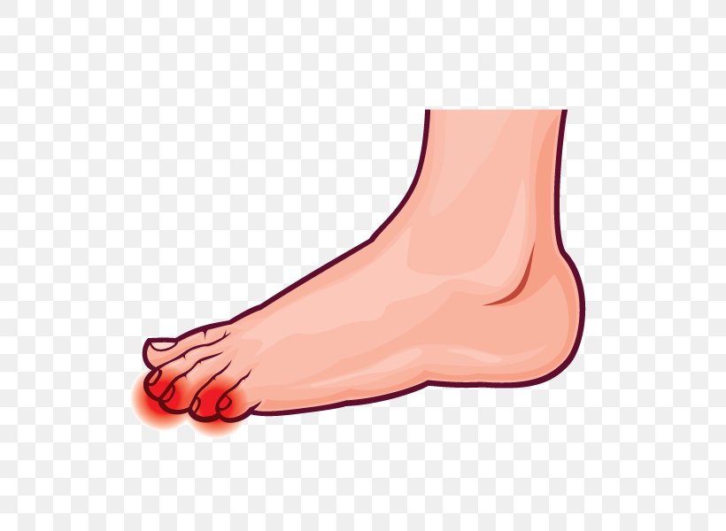 Thumb Toe Ankle Pronation Of The Foot, PNG, 600x600px, Watercolor, Cartoon, Flower, Frame, Heart Download Free