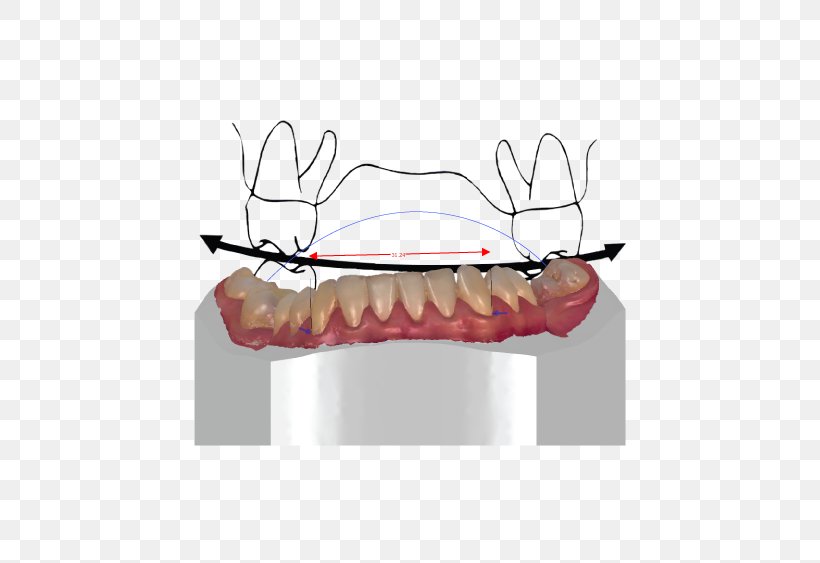 Orthodontics Tooth CAD/CAM Dentistry Orthodontic Technology, PNG, 640x563px, Watercolor, Cartoon, Flower, Frame, Heart Download Free