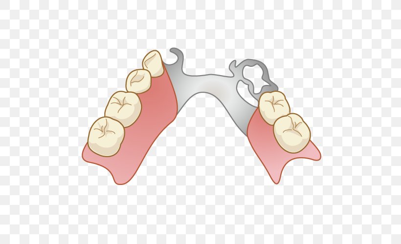 Dentures Dentist Removable Partial Denture Dental Technician Tooth Decay, PNG, 500x500px, Dentures, Dental Implant, Dental Technician, Dentist, Dentistry Download Free