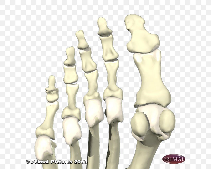 Finger Sesamoid Bone Foot First Metatarsal Bone, PNG, 660x660px, Finger, Arm, Bone, Bone Fracture, First Metatarsal Bone Download Free