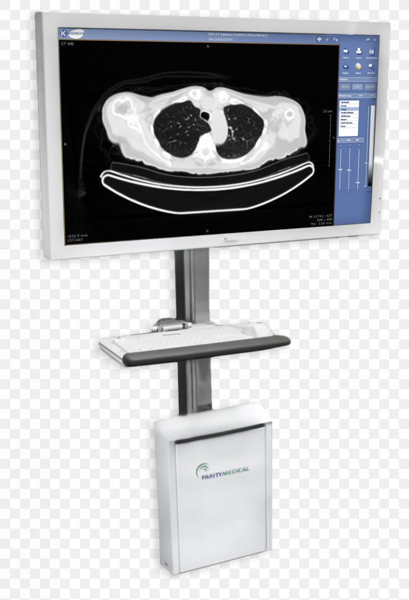 Medicine Picture Archiving And Communication System Radiology Display Device McKesson Corporation, PNG, 852x1250px, Medicine, Computer, Computer Monitor Accessory, Computer Monitors, Computer Software Download Free
